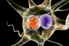 Ngăn chặn ung thư não theo chiến lược của virus bệnh dại